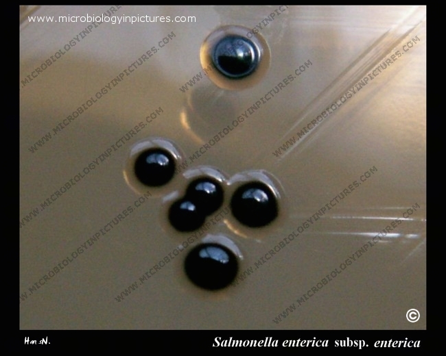 salmonella colonies on desoxycholate citrate agar